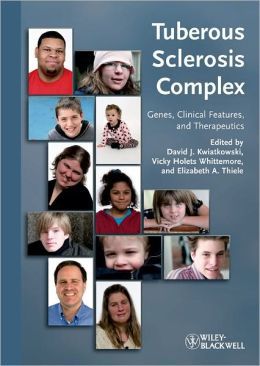 Tuberous Sclerosis Complex: Genes, Clinical Features and ...