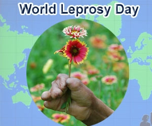 why anti leprosy week celebrated in that specific week?
