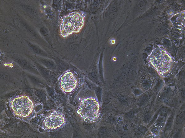 New national stem cell resource - Wellcome Trust Sanger Institute