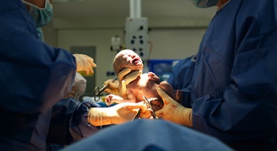 Caesarean Sections are usually done earlier in morning?