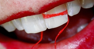 Flossing Day - Question about flossing and how many times a day?