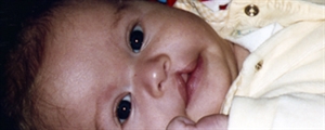 National Cleft & Craniofacial Awareness and Preven - July is National Cleft and